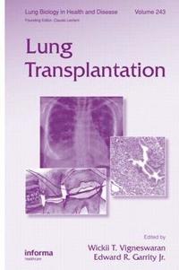 bokomslag Lung Transplantation