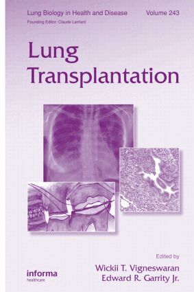 Wickii Vigneswaran, Edward R. Garrity Jr. - Lung Transplantation, Inbunden