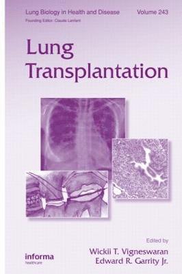 bokomslag Lung Transplantation