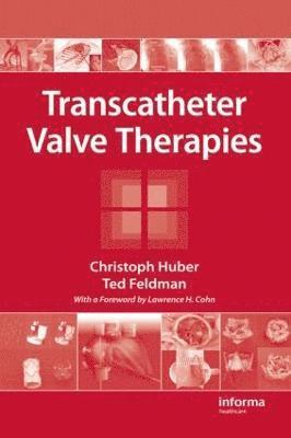 bokomslag Transcatheter Valve Therapies