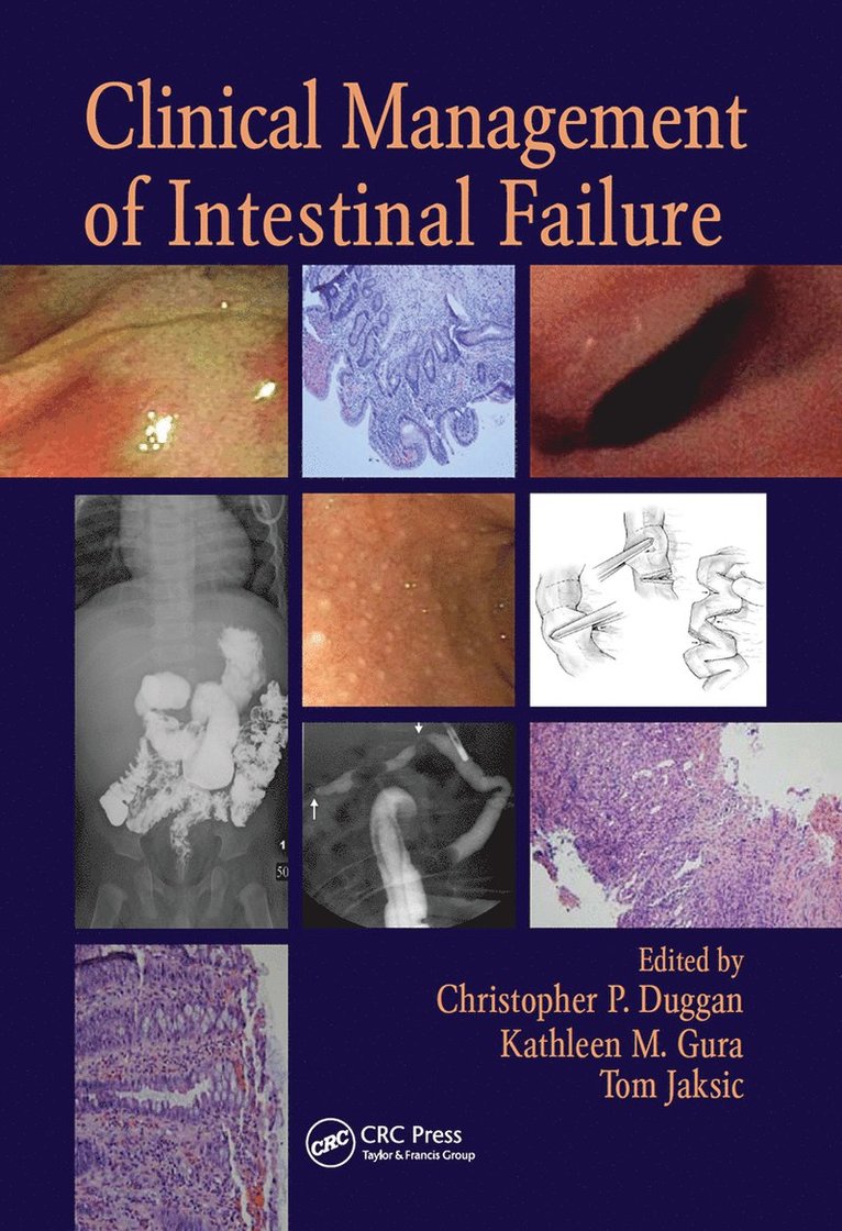 Christopher P. Duggan, Kathleen M. Gura, Tom Jaksic - Clinical Management of Intestinal Failure, Inbunden