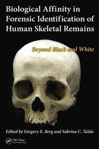 bokomslag Biological Affinity in Forensic Identification of Human Skeletal Remains