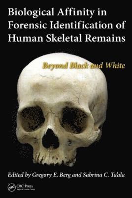 Biological Affinity in Forensic Identification of Human Skeletal Remains 1