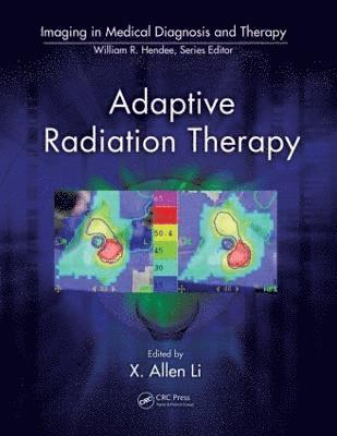 Adaptive Radiation Therapy 1