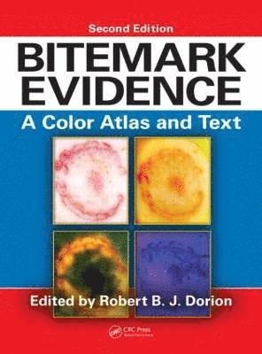 bokomslag Bitemark Evidence