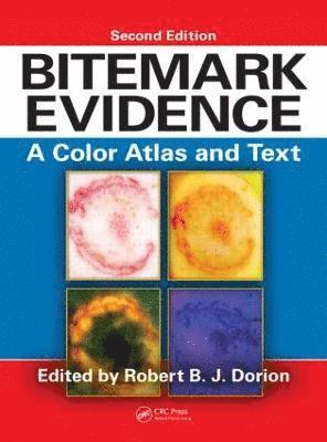 Bitemark Evidence 1