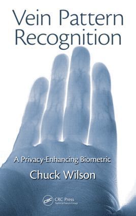 Vein Pattern Recognition 1