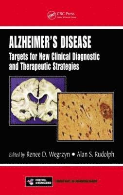 bokomslag Alzheimer's Disease