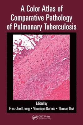 bokomslag A Color Atlas of Comparative Pathology of Pulmonary Tuberculosis