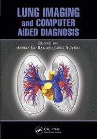 bokomslag Lung Imaging and Computer Aided Diagnosis