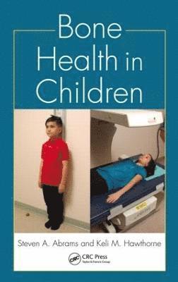 bokomslag Bone Health in Children