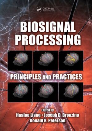 Hualou Liang, Joseph D. Bronzino, Donald R. Peterson - Biosignal Processing, Inbunden