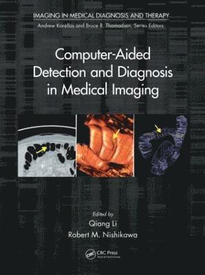Computer-Aided Detection and Diagnosis in Medical Imaging