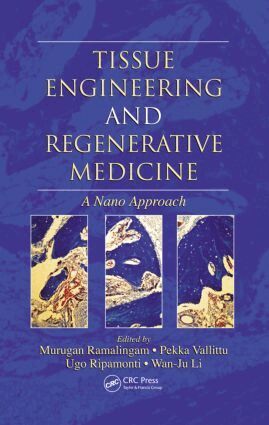 Murugan Ramalingam, Pekka Vallittu, Ugo Ripamonti, Wan-Ju Li - Tissue Engineering and Regenerative Medicine, Inbunden