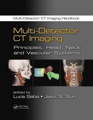 bokomslag Multi-Detector CT Imaging