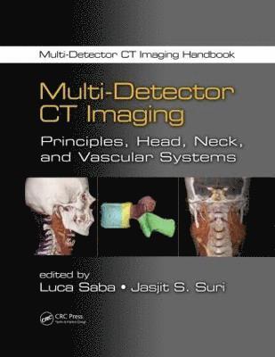Multi-Detector CT Imaging