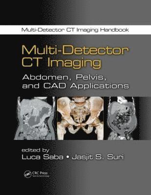 bokomslag Multi-Detector CT Imaging