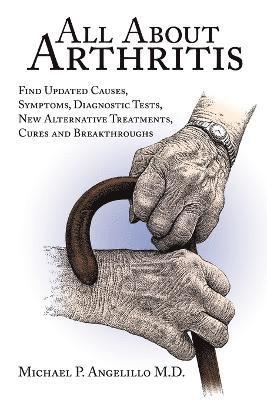 All about Arthritis- Find Updated Causes, Symptoms, Diagnostic Tests, New Alternative Treatments, Cures and Breakthroughs 1