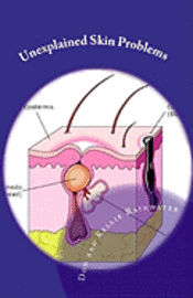 bokomslag Unexplained Skin Problems: Home Treatment And Precautions