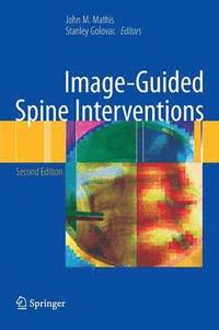 bokomslag Image-Guided Spine Interventions