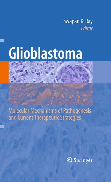 bokomslag Glioblastoma: