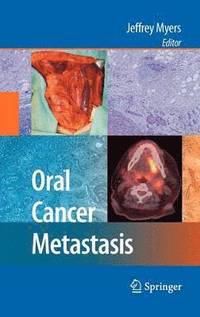 bokomslag Oral Cancer Metastasis