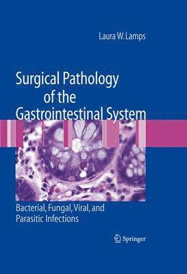 Laura W. Lamps - Surgical Pathology of the Gastrointestinal System: Bacterial, Fungal, Viral, and Parasitic Infections, Inbunden