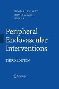 bokomslag Peripheral Endovascular Interventions