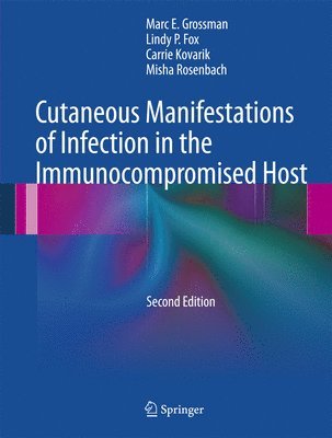 bokomslag Cutaneous Manifestations of Infection in the Immunocompromised Host