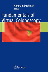 bokomslag Fundamentals of Virtual Colonoscopy