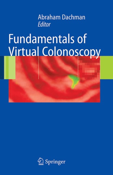 bokomslag Fundamentals of Virtual Colonoscopy