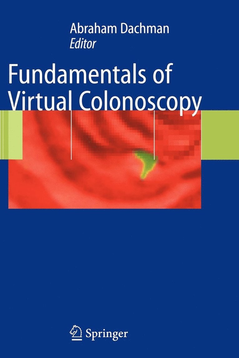 Fundamentals of Virtual Colonoscopy