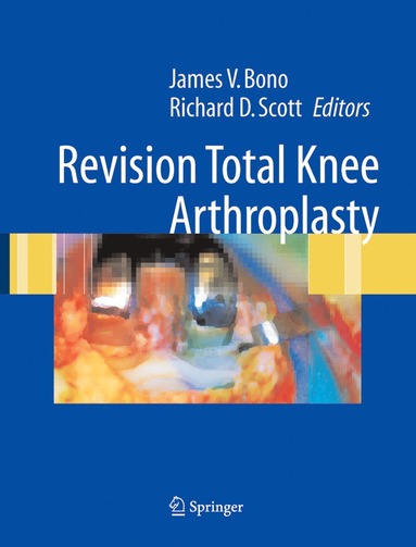 bokomslag Revision Total Knee Arthroplasty