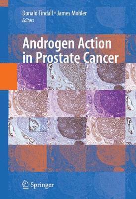 Androgen Action in Prostate Cancer 1