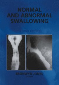 bokomslag Normal and Abnormal Swallowing