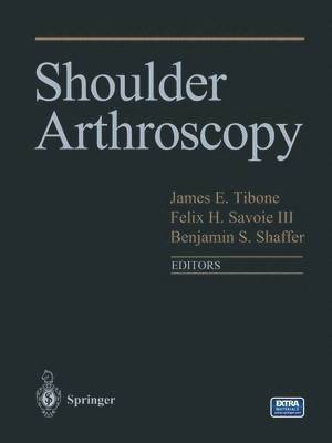 Shoulder Arthroscopy 1