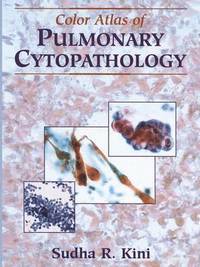 bokomslag Color Atlas of Pulmonary Cytopathology
