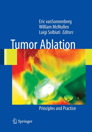 Eric van Sonnenberg, William McMullen, Luigi Solbiati - Tumor Ablation, Häftad