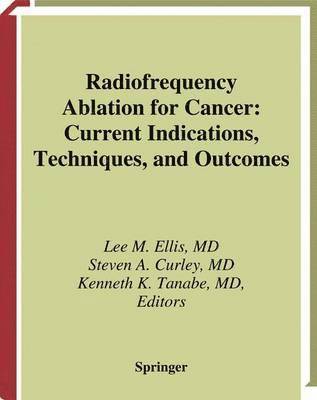 Radiofrequency Ablation for Cancer 1