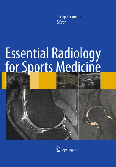 Philip Robinson - Essential Radiology for Sports Medicine, Inbunden