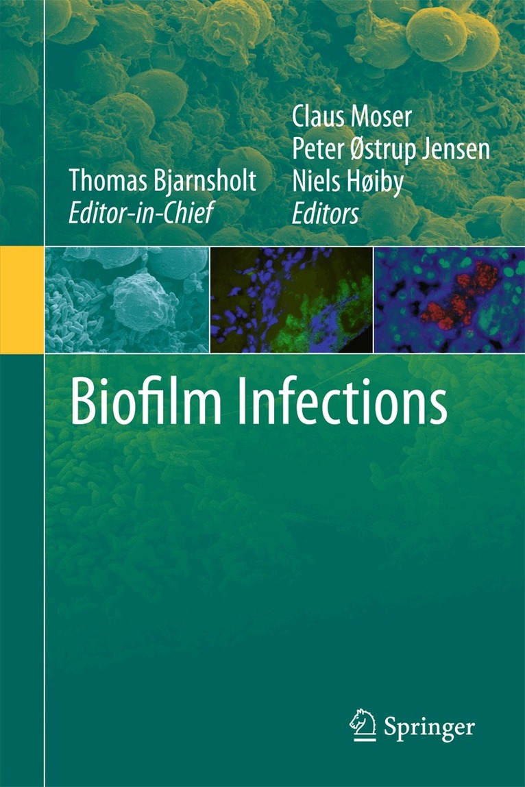 Thomas Bjarnsholt, Claus Moser, Peter Østrup Jensen, Niels Høiby - Biofilm Infections, Inbunden