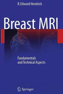 bokomslag Breast MRI