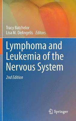Lymphoma and Leukemia of the Nervous System