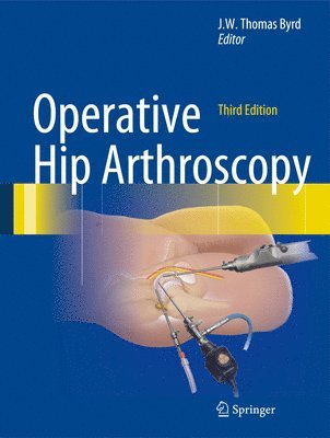 bokomslag Operative Hip Arthroscopy