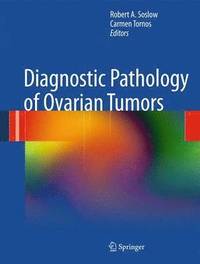 bokomslag Diagnostic Pathology of Ovarian Tumors