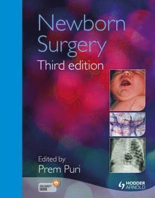 Newborn Surgery