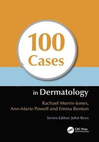 bokomslag 100 Cases in Dermatology