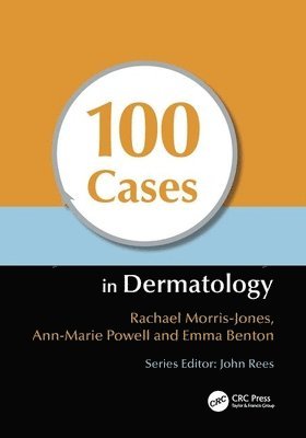 100 Cases in Dermatology 1