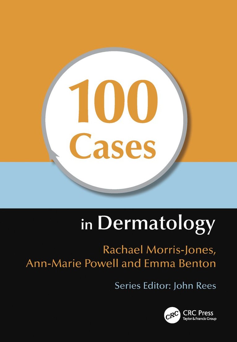 Rachael Morris-Jones, Ann-Marie Powell, Emma Benton, UK) Morris-Jones, Rachael (PhD PCME FRCP Consultant Dermatologist & Honorary Senior Lecturer, King’s College Hospital, London, UK) Powell, Ann-Marie (Consultant Dermatologist, Department of Dermatology, St Thomas’ Hospital, London, UK) Benton, Emma (MB ChB MRCP Post-CCT Clinical Research Fellow, St John’s Institute of Dermatology, Guy’s and St Thomas’ NHS Trust, London - 100 Cases in Dermatology, Häftad