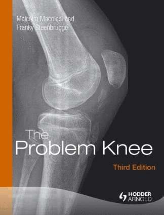 The Problem Knee 1